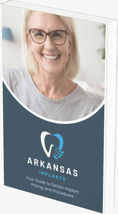 Arkansas Implants dental guide cover